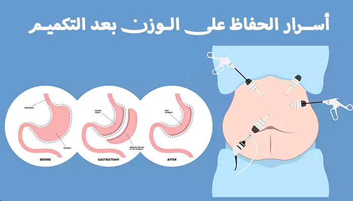 أسرار الحفاظ على الوزن بعد التكميم: نصائح غذائية ورياضية مُجربة