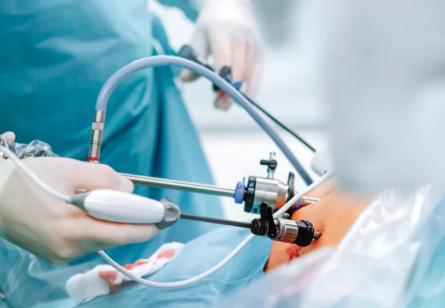 جراحة السمنة بالمنظار: مميزاتها وتفاصيلها